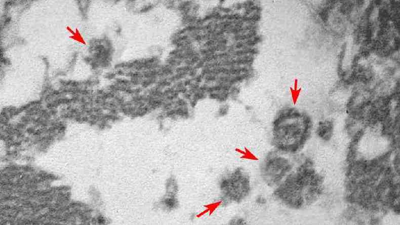 Imagem gerada por microscopia eletrnica revela 'a presena de vrus com tamanho e forma de Sars-CoV-2 (indicados pelas setas) no interior das clulas musculares cardacas lesadas'(foto: Elia Caldini/FMUSP)
