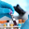 Exame de sangue: teste identifica mais de 50 tipos de câncer