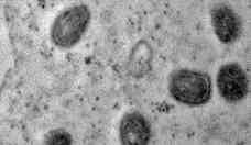 Fiocruz registra imagens de replicao do vrus monkeypox em clula