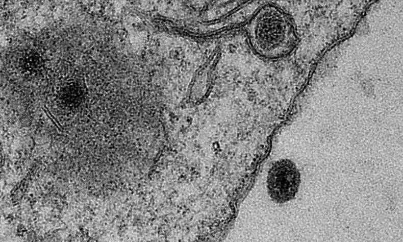Yaravrus, misterioso micro-organismo encontrado na Lagoa da Pampulha, infecta ameba em laboratrio.(foto: Jnatas Abraho e IHU-Marseille/Centro de Microscopia UFMG)