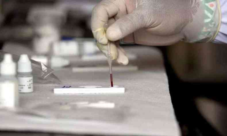 Teste sendo realizado para investigar os casos de hepatite infantil misteriosa 