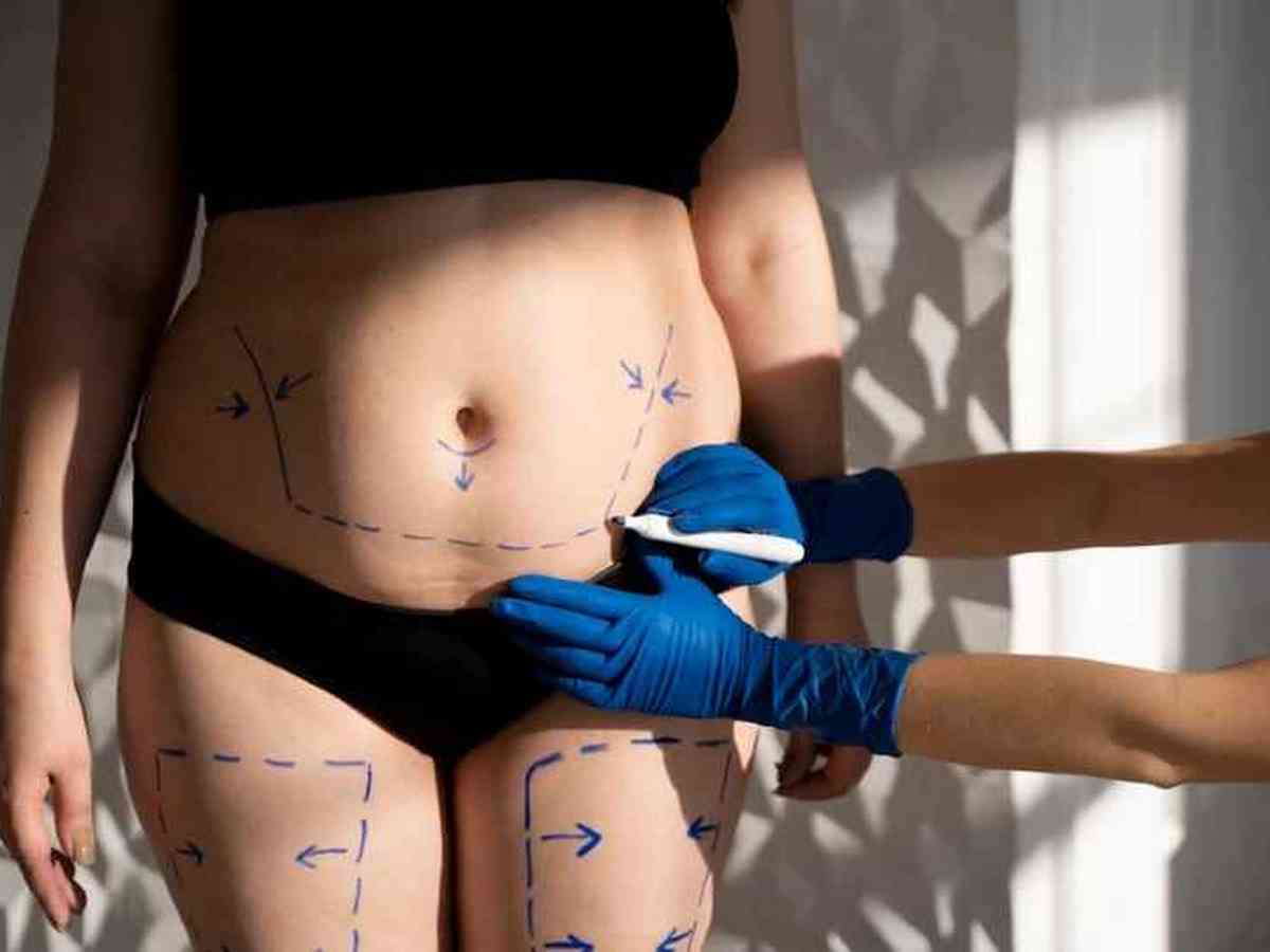Isa Scherer abre o jogo sobre cirurgia plástica pós-gravidez