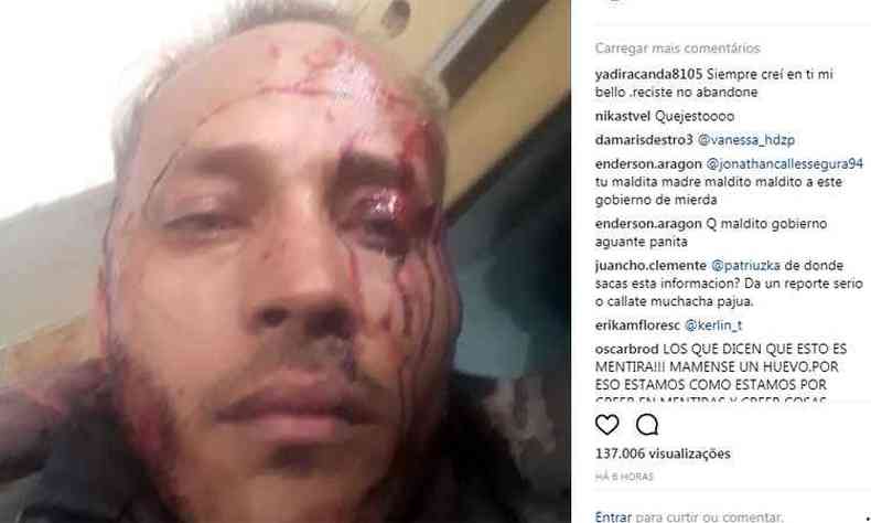 Ex-policial divulgou vdeo com o rosto ensanguentado. Durante a gravao, barulhos de tiros so ouvidos(foto: Reproduo/Instagram)
