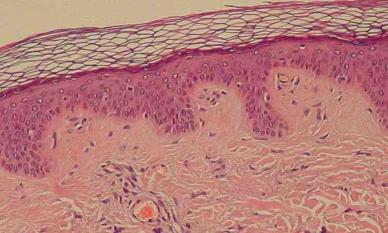 Corte de pele mostrando tecido epitelial estratificado pavimentoso com camada crnea, em rosa escuro.(foto: Kilbad, 2008)
