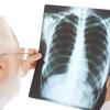  Dia Mundial de Combate à Tuberculose ressalta importância do exame preciso