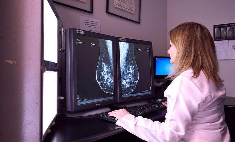 Mdica analisa mamografia
