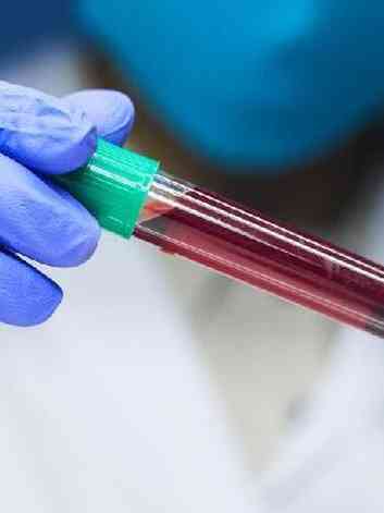 medico segurando um tubo de amostra de sangue 