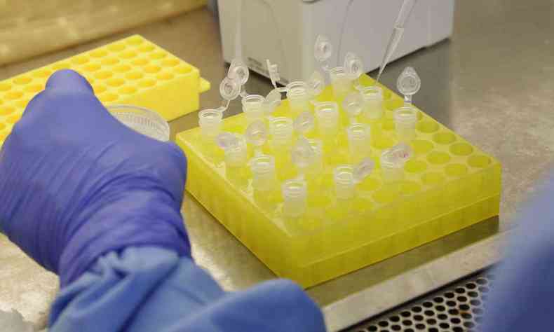 Testes rpidos podem detectar a presena do vrus em pessoas assintomticas(foto: Josu Damacena/IOC/Fiocruz)