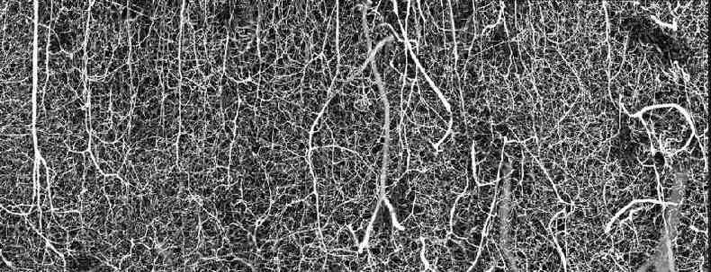 No, esta no  uma estranha floresta congelada de conto de fadas %u2014  o interior do crebro de um rato! A imagem superdetalhada da rede vascular do crtex somatossensorial de um rato adulto foi tirada por Andrea Tedeschi, da Universidade do Estado de Ohio, nos EUA