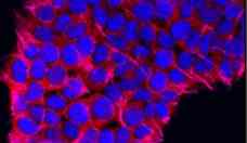 Cncer de pncreas: pesquisa com vacina de mRNA para combater o tumor