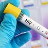 HIV: mesmo com antirretroviral, vírus não fica totalmente adormecido