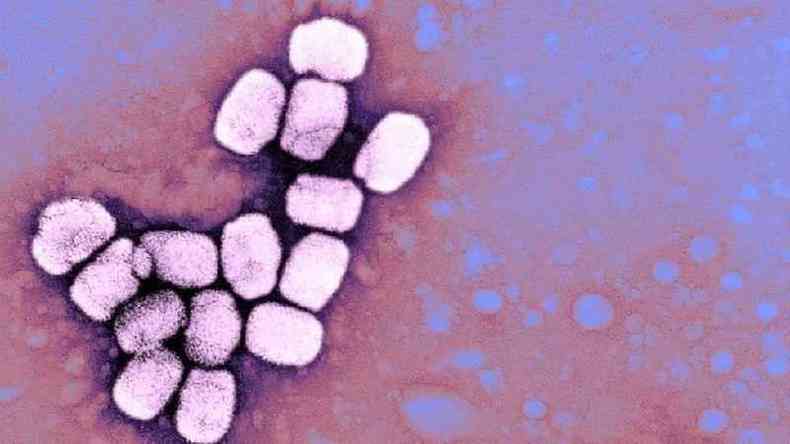 Varíola é causada por um vírus(foto: Getty)