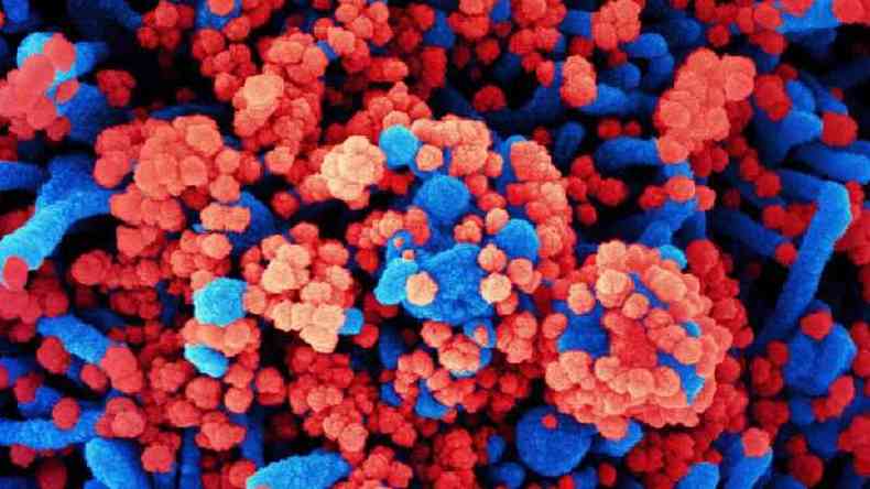 Clulas de paciente (em azul) infectadas com partculas do coronavrus (vermelho) em imagem do tipo micrografia eletrnica, divulgada pelo National Institutes of Health dos EUA(foto: EPA/NIAID)