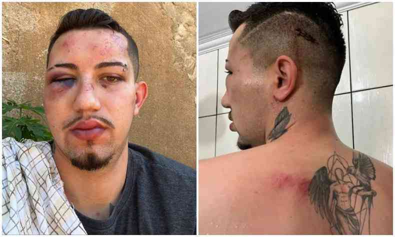 Duas fotos, uma de frente e outra de costas, de Marcos Mendonça Gonçalves, de 23 anos, que foi espancado por policiais militares em abordagem policial em Paineiras