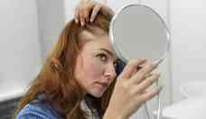 Queda de cabelo na infncia e adolescncia pode indicar distrbio hormonal