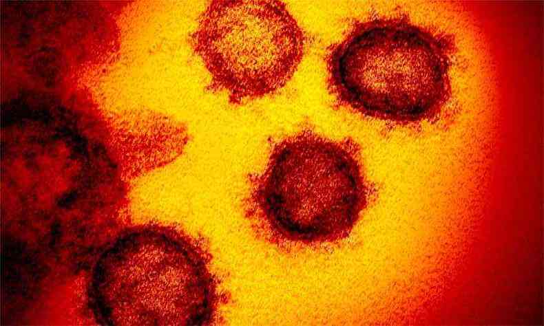 Células em laboratório que estuda o coronavírus(foto: AFP/Institutos Nacionais de Saúde )