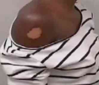 Menina sofreu graves leses durante mais de 4 horas de tortura(foto: Reproduo/TV Alterosa)