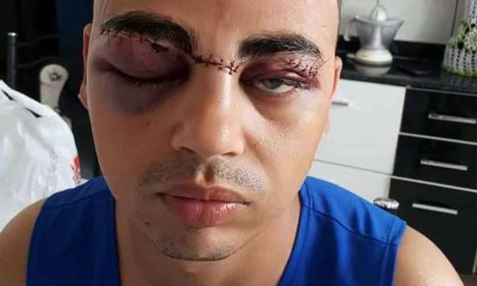 Cerol é uma brincadeira perigosa que tem matado e ferido motociclistas em todo o país (foto: Reprodução/Facebook) Cerol é uma brincadeira perigosa que tem matado e ferido motociclistas em todo o país (foto: Reprodução/Facebook)