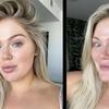 Veja quais são os perigos dos polêmicos filtros de beleza do TikTok