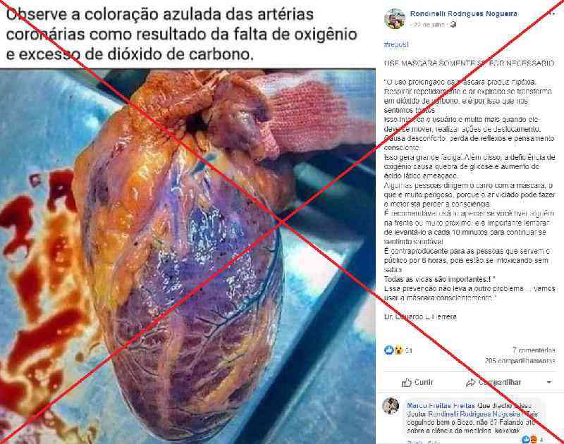 A falta de oxigênio é real, nos hospitais e nas democracias