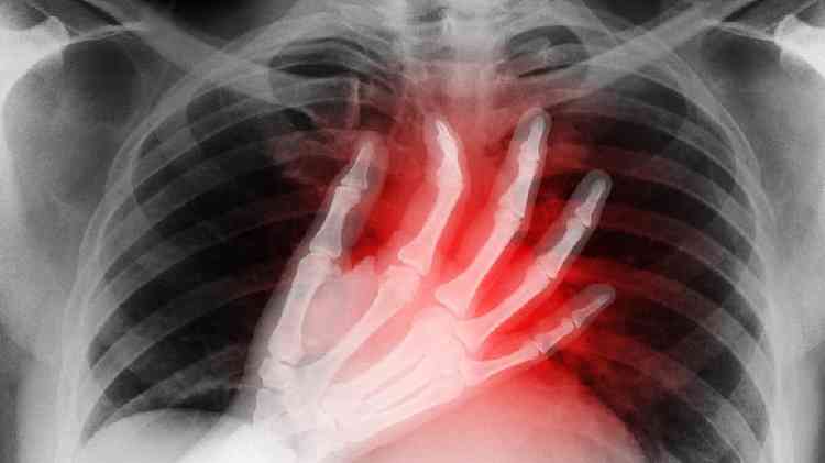 Ilustração de imagem mostrando um raio-x com um coração