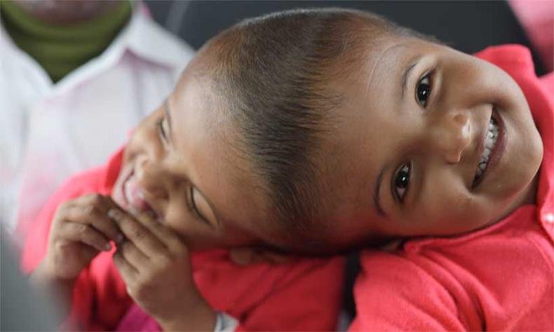 Rabeya e Rukaya, de tr�s anos de idade, nasceram com seus cr�nios unidos no alto(foto: MIKLOS BEMER / ADPF / AFP)