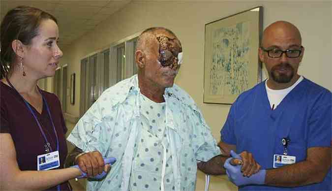 Sem teto de 65 anos, que perdeu grande parte do rosto, est estvel(foto: REUTERS/Jackson Memorial Hospital/Handout )