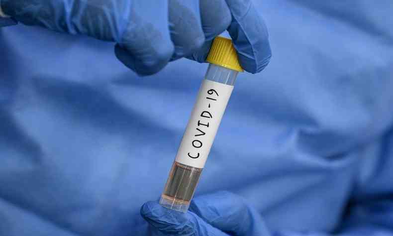 Mundo passou de 16 milhes de infeces confirmadas por COVID-19 neste domingo(foto: Sajjad Hussain/AFP)