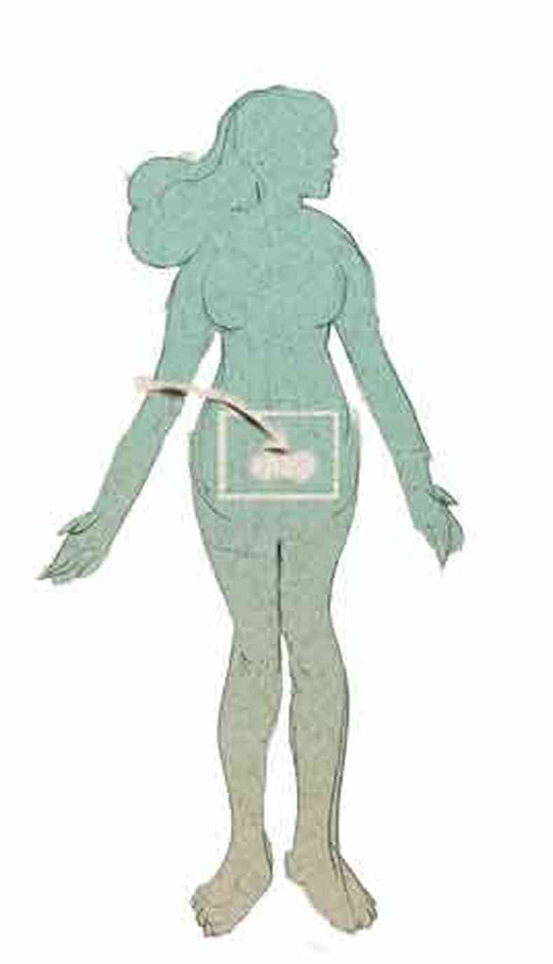 Ilustração da coluna Anna Marina mostra mulher e detalhe da bexiga dela