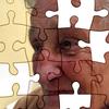 Doença de Alzheimer: avanços e desafios para pacientes