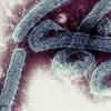 Vírus letal: OMS confirma mortes e surto de Marburg, primo do Ebola