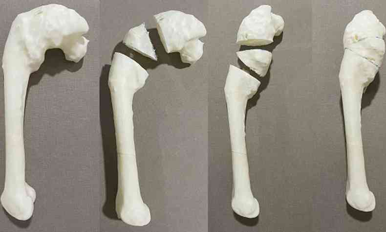 Rplicas em plstico de ossos produzidas em impresso tridimensional (3D)