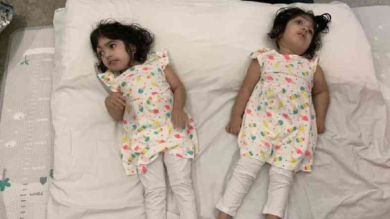 Safa e Marwa tiveram alta do hospital cinco meses aps a cirurgia, mas continuaram morando em Londres por um tempo(foto: BBC)