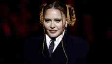 Reversão estética: Madonna passa por tratamentos para restaurar aparência