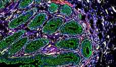 Mapeamentos de estruturas celulares ajudam a entender formao de doenas