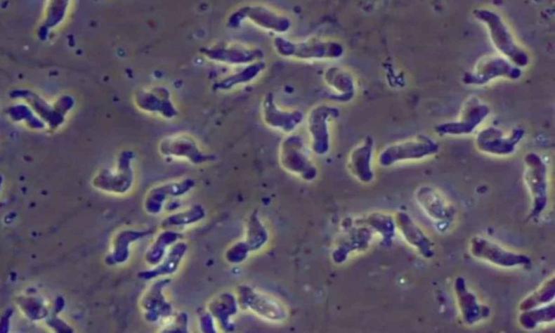 Os cientistas chamam atenção para o fato de que, além dos lagos, outras fontes de contaminação pela ameba estão sendo documentadas, como água não tratada(foto: Divulgação/CDC) Amebas ''comedoras de cérebro''