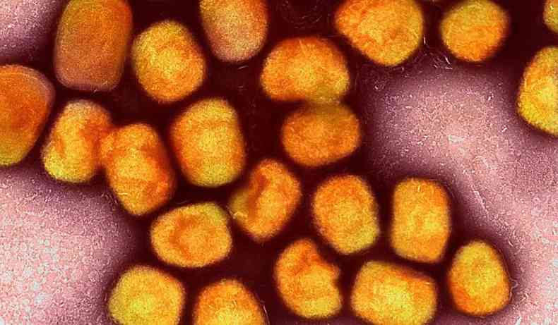 Imagem microscópica do vírus.
