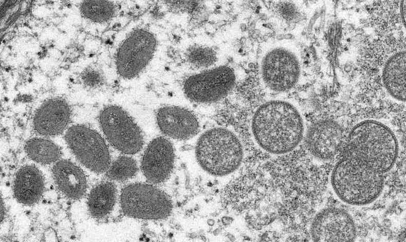 Imagens de microscópio da varíola