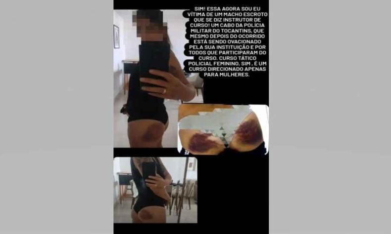 Fotomontagem. Mulher mostra agresses no corpo. 