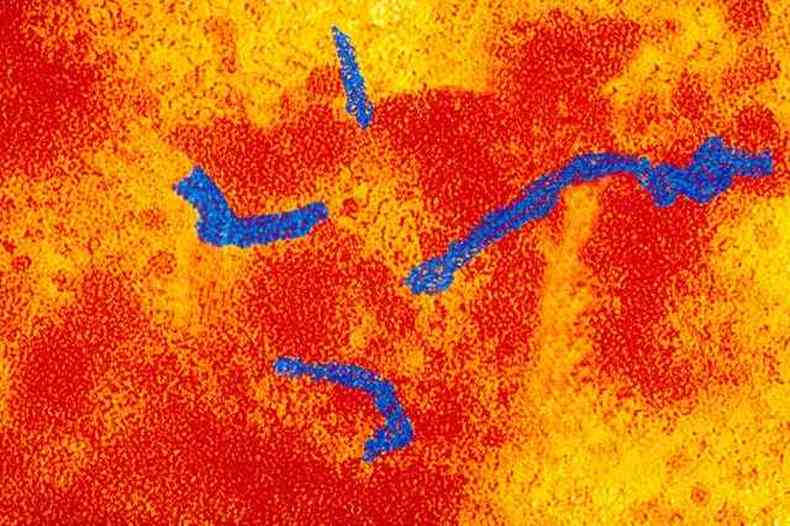 O vírus do sarampo no microscópio.(foto: Sanofi Pasteur via Flickr Creative Commons)