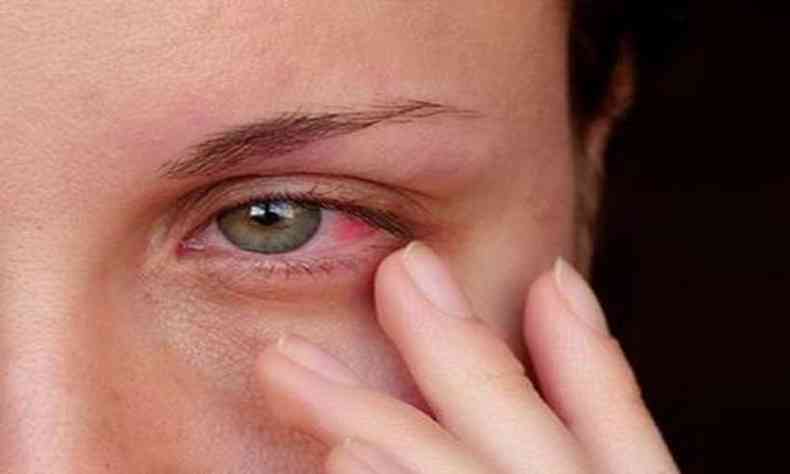 Irritação nos olhos: maior tempo de exposição às telas pode