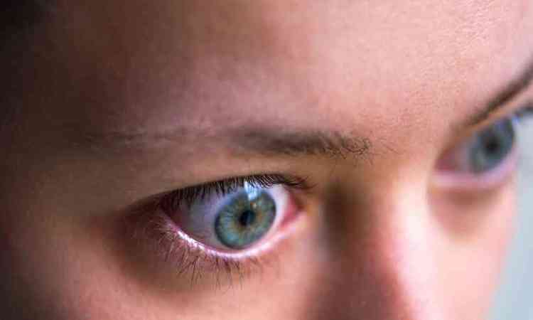 Mulher branca com os olhos azuis acentuados inchados para fora 