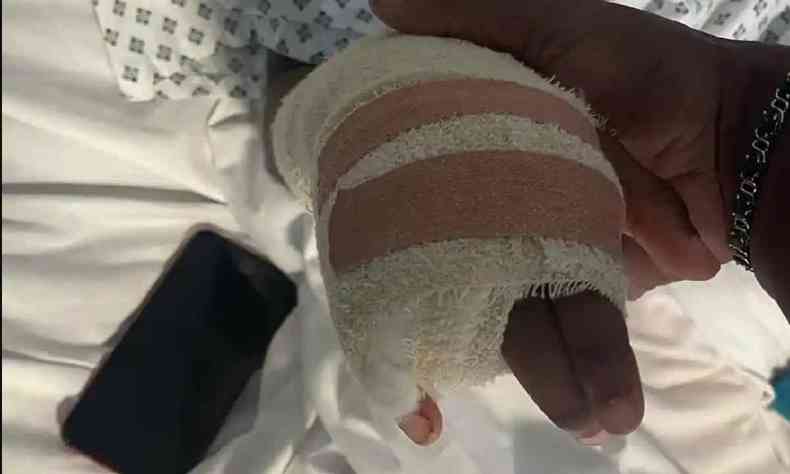 Foto em close da mão enfaixada de Raheem ainda no hospital, onde falta o dedo anelar
