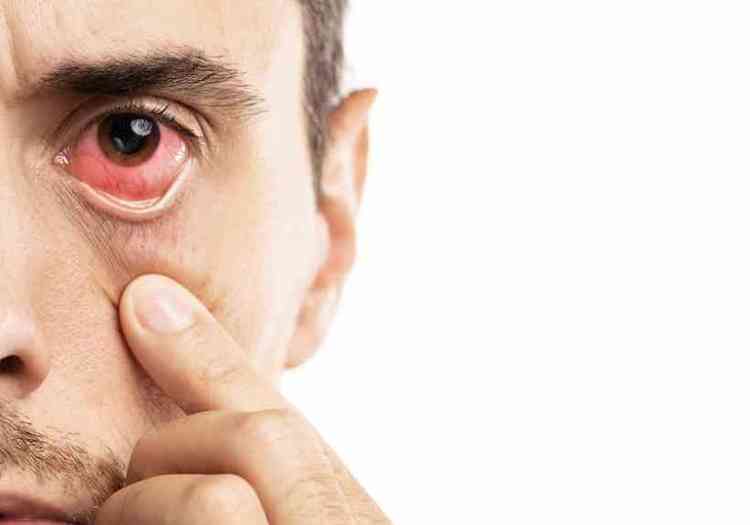 Olho Vermelho, dos Sintomas ao Diagnóstico e Tratamento
