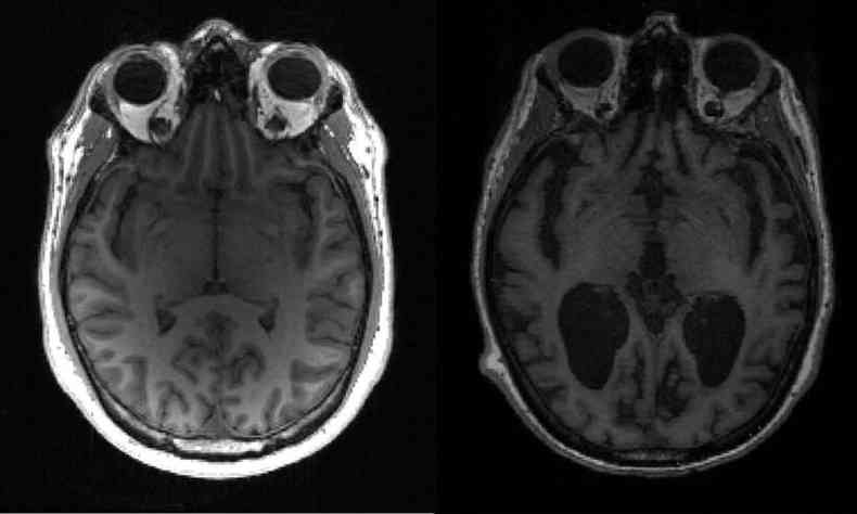 Radiografias de crebro