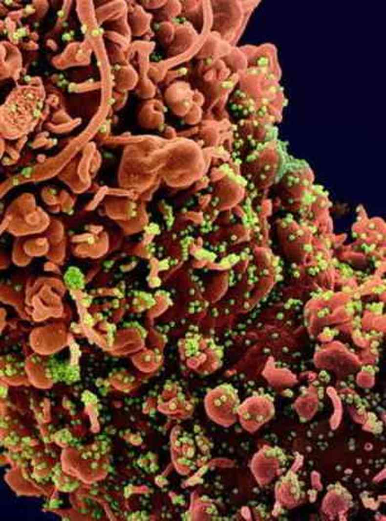 Representao divulgada pelo Instituto Nacional de Alergias e Doenas Infecciosas dos EUA mostra clulas infectadas por novo coronavrus(foto: EPA/Divulgao)