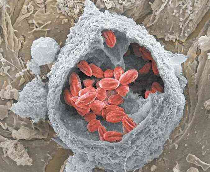 Vacolos parasitforos desenvolvidos pelo protozorio Leishmania amazonensis (em vermelho)em macrfago de camundongo (cinza). Imagem obtida em microscpio eletrnico de varredura por emisso de campo a partir de amostra fraturada por fita adesiva. Dezenas de parasitas esto alojados em espaosos compartimentos intracelulares do macrfago hospedeiro. Nesses vacolos espaosos o parasita se refugia do sistema imune do hospedeiro. Produzida por Fernando Real, um dos autores da pesquisa, a imagem ficou em segundo lugar na categoria Dimensomicro da edio 2012 do Prmio Fotografia/CNPq(foto: FERNANDO REAL/DIVULGAO)