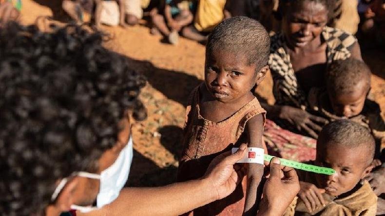 Pelo menos meio milhão de crianças com menos de cinco anos de idade enfrentam risco de desnutrição aguda, segundo a ONU(foto: WFP/Tsiory Andriantsoarana) Pelo menos meio milhão de crianças com menos de cinco anos de idade enfrentam risco de desnutrição aguda, segundo a ONU(foto: WFP/Tsiory Andriantsoarana)