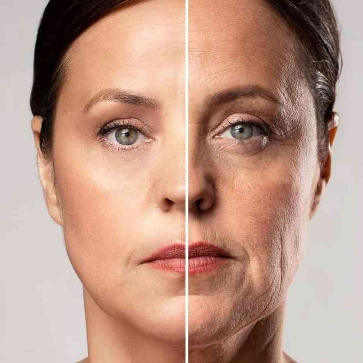 Flacidez facial: o que causa, como prevenir e como tratar a pele – Sallve