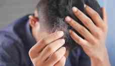 Saiba como tratar a alopecia areata com apenas trs ingredientes